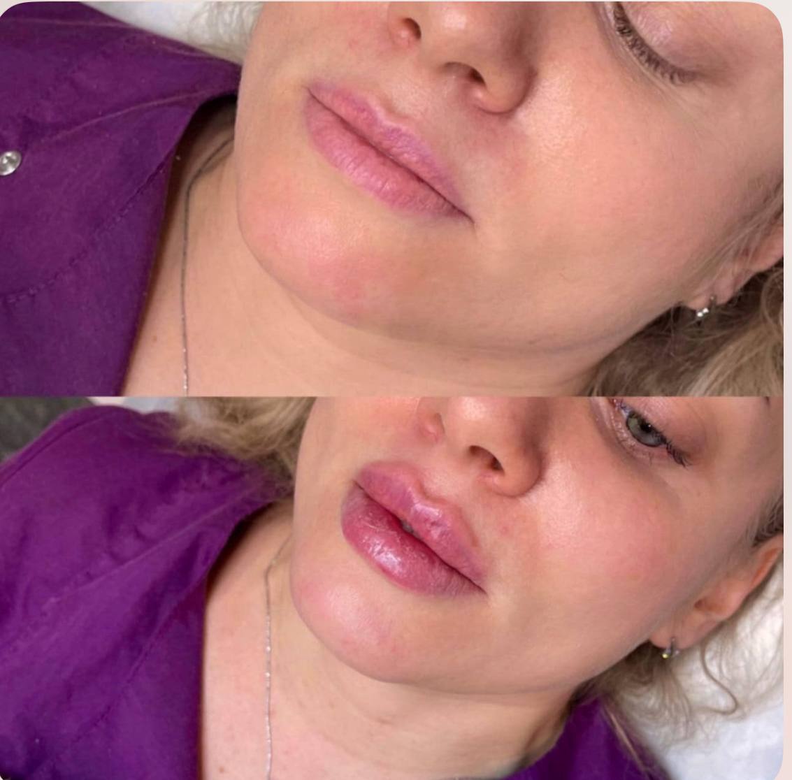 Behandlingsresultat 1