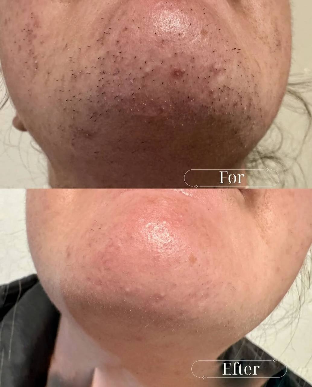 Behandlingsresultat 10