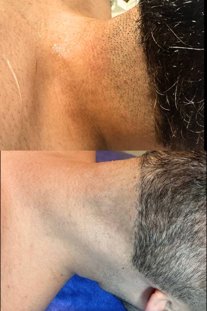 Behandlingsresultat 12