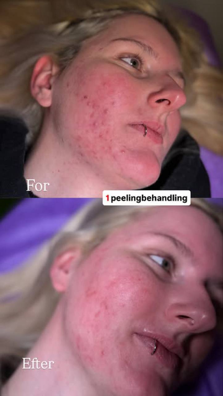 Behandlingsresultat 13