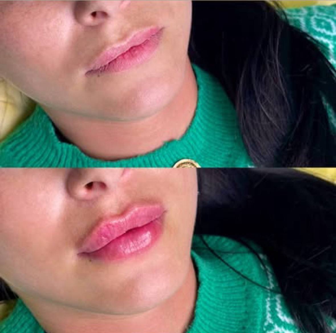 Behandlingsresultat 2