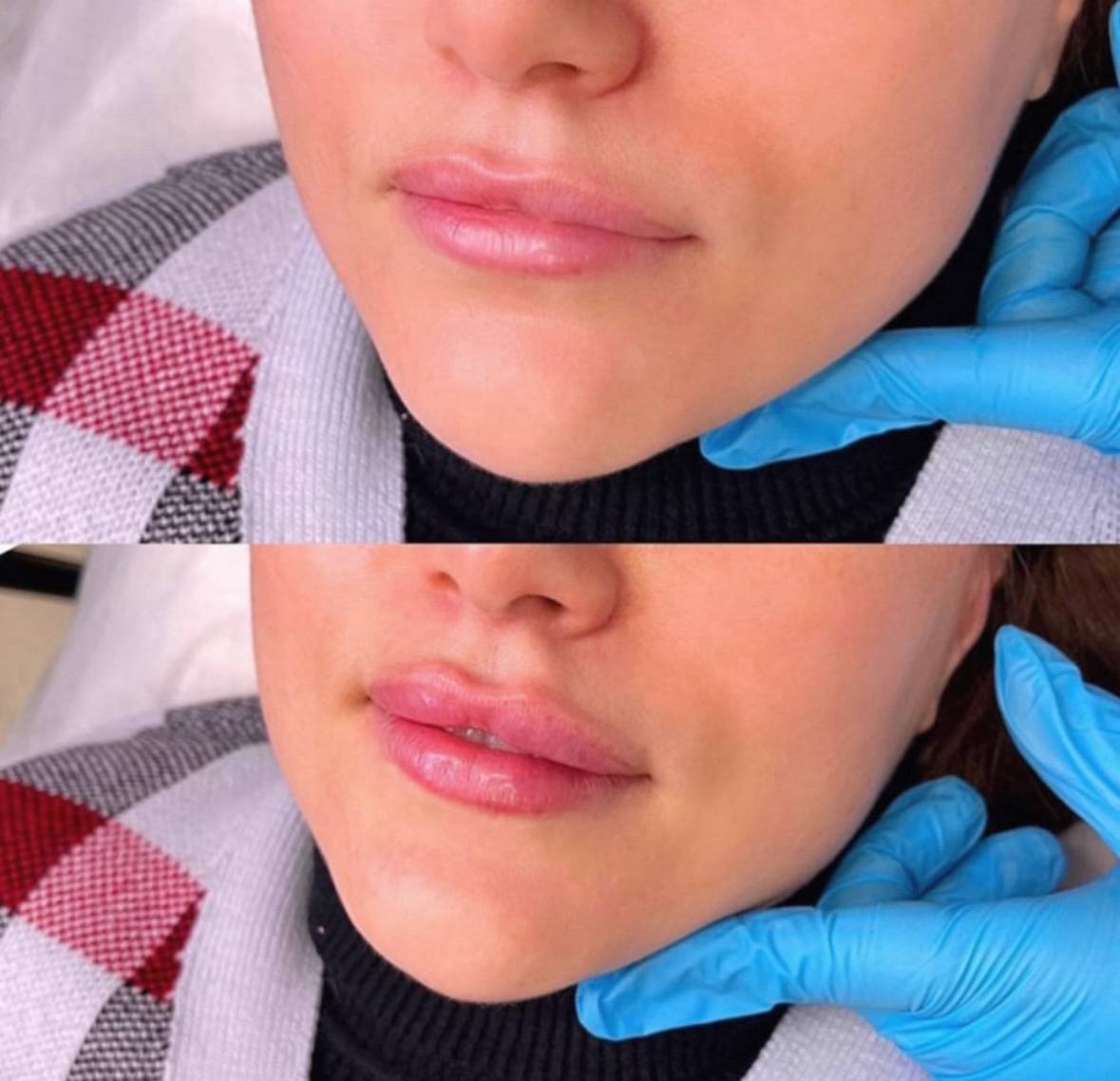 Behandlingsresultat 3