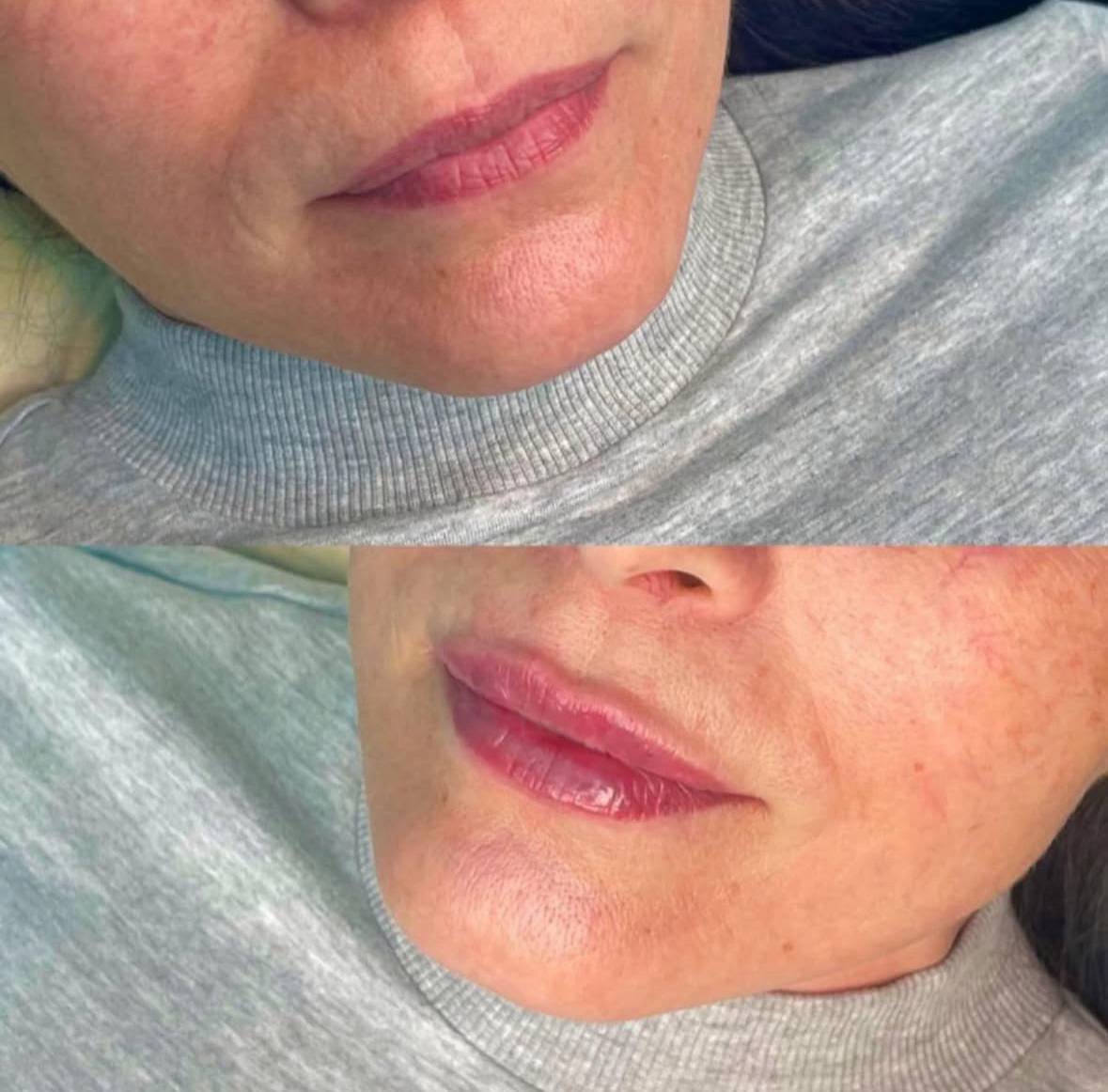 Behandlingsresultat 4