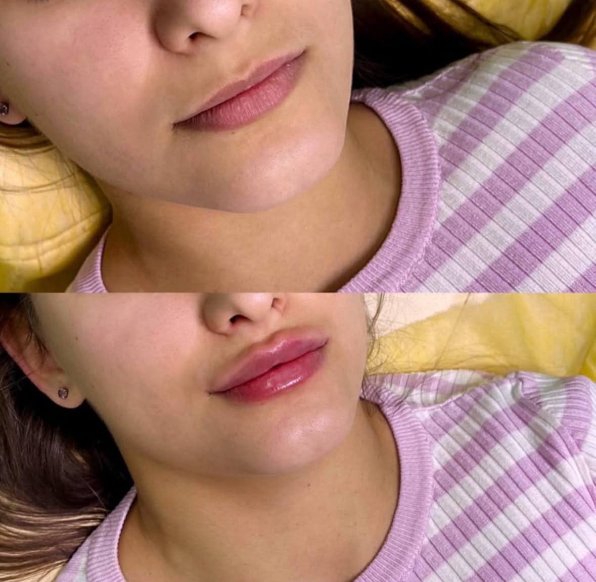 Behandlingsresultat 5