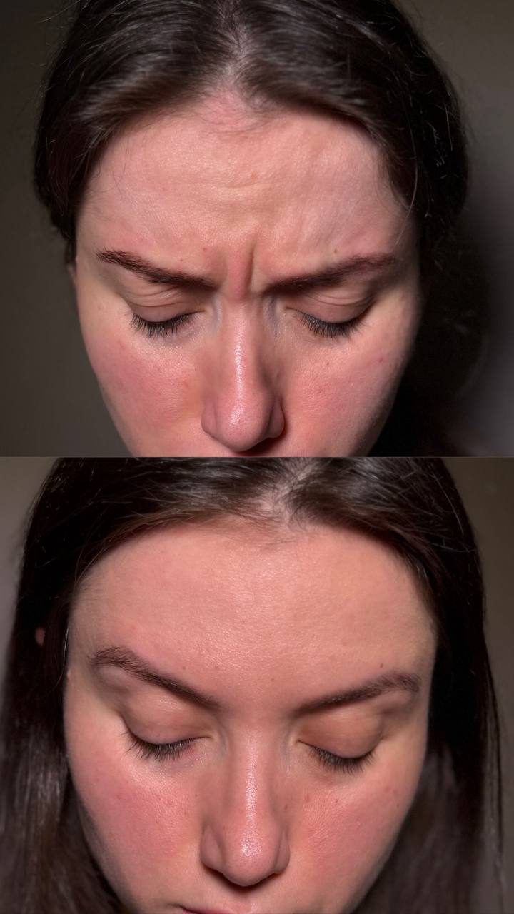 Behandlingsresultat 6