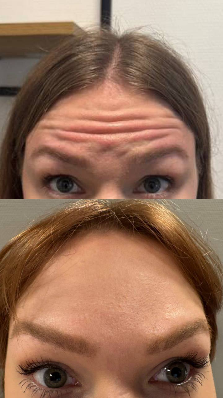 Behandlingsresultat 7