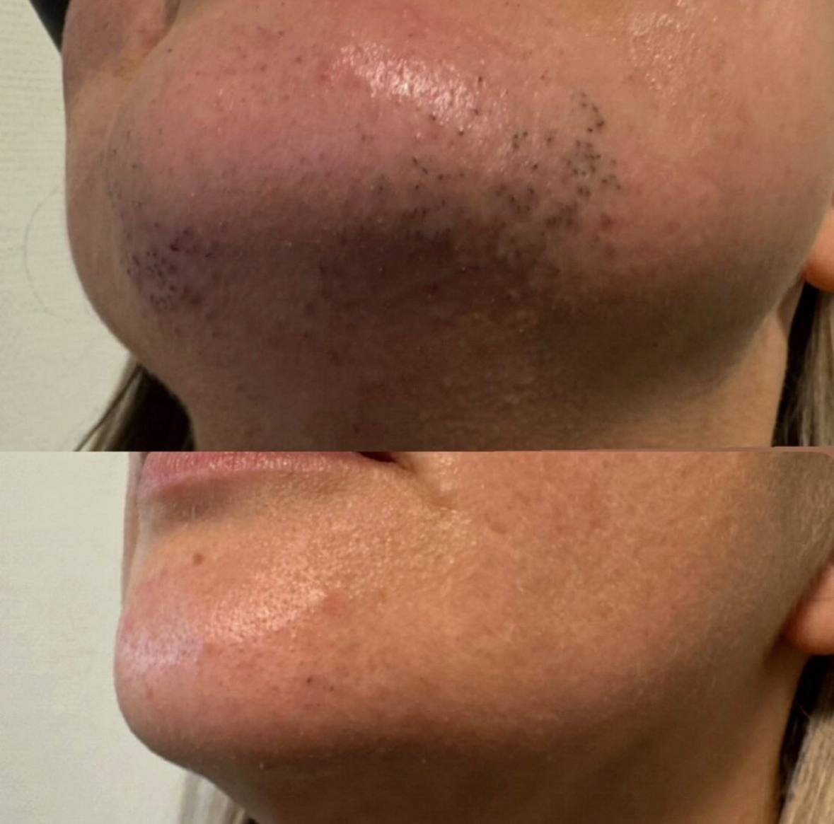 Behandlingsresultat 9